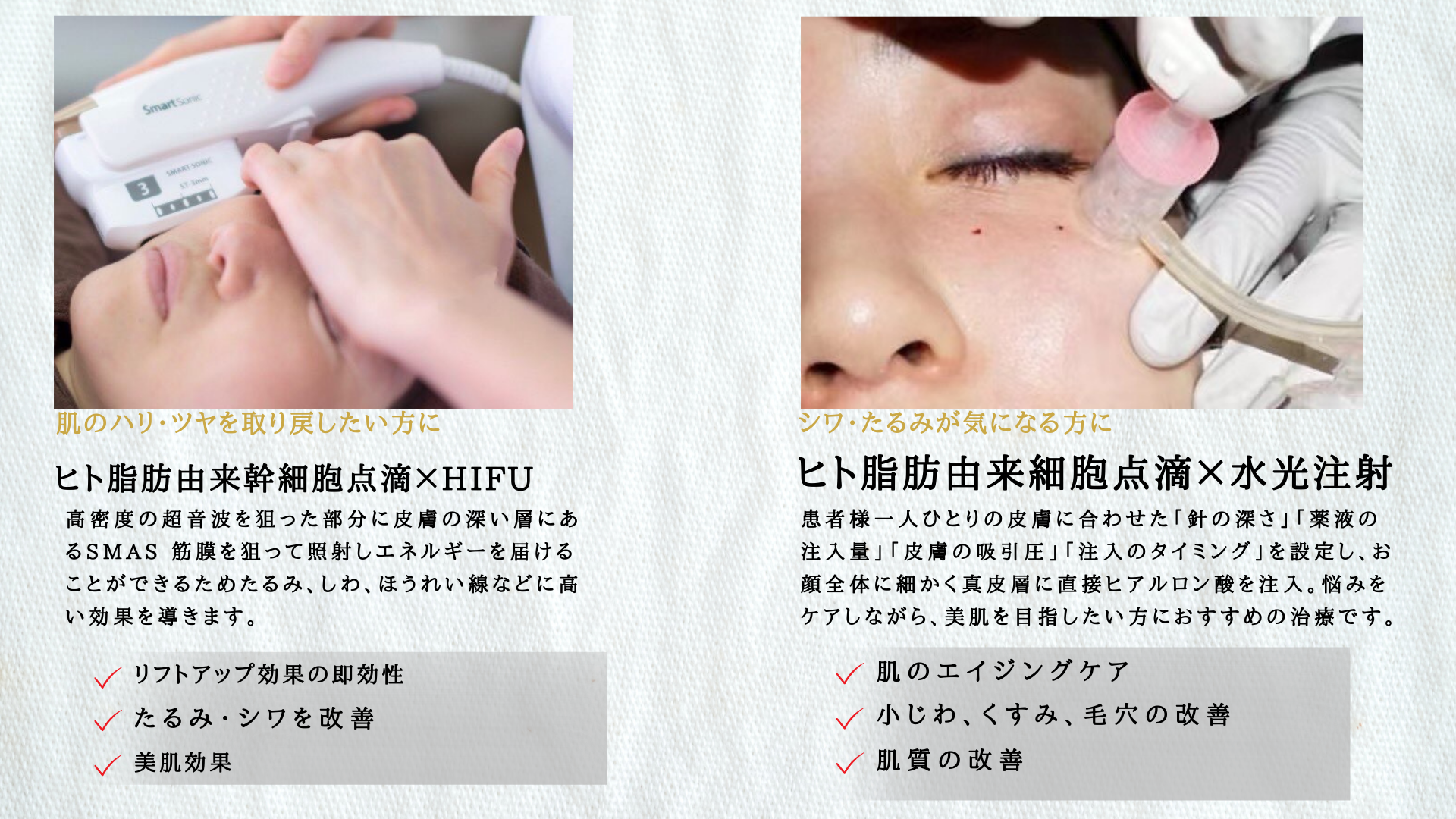 ヒト脂肪由来幹細胞点滴×HIFU
ヒト脂肪由来細胞点滴×水光注射